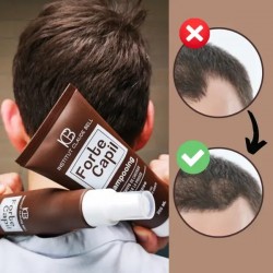 FORTE CAPIL Shampooing, lotion et baume - réduisent la perte de cheveux androgénétique ou hormonale