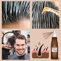 FORTE CAPIL Shampooing, lotion et baume - réduisent la perte de cheveux androgénétique ou hormonale
