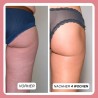 Complex gegen Cellulite und Fett + Wichelhose dazu