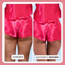 Complex gegen Cellulite und Fett + Wichelhose dazu