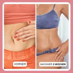 Complex gegen Cellulite und Fett + Wichelhose dazu