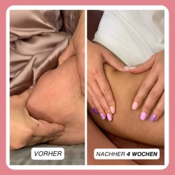 Complex gegen Cellulite und Fett + Wichelhose dazu